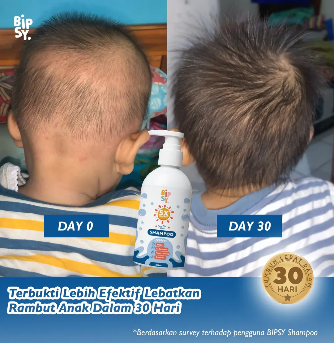 Perbandingan rambut anak hari ke-0 dan hari ke-30